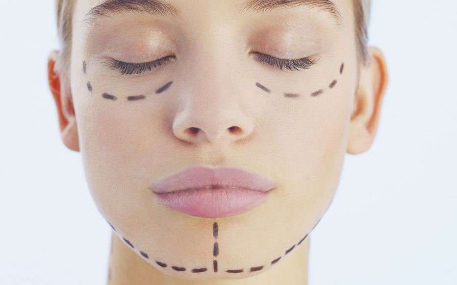 Trois méthodes soft de médecine esthétique pour prendre soin de sa peau